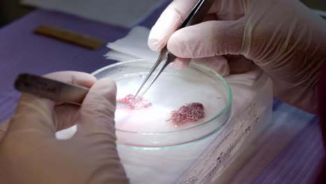 Cell-culture-of-single-hair-follicles-for-transplantation-being-prepared-in-a-petri-dish-using-forceps,-medical-instruments