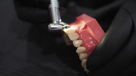 Dental-Polishing-Demonstration-with-Grinding-point-Drill---Detail-close-up