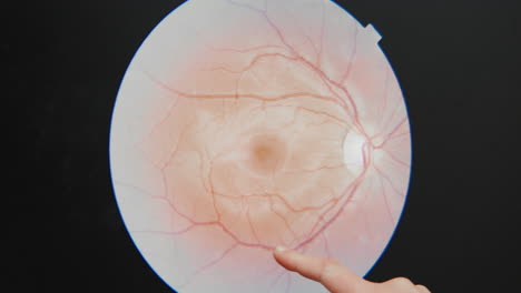 Oculista-Oculista-Optometrista-Muestra-Daños-Al-Paciente-Cliente-En-Los-Ojos-Vasos-Sanguíneos-En-El-Chequeo-De-Atención-Médica-Necesita-Prescripción-Para-Anteojos-Médico-Quirúrgico-Ojo-Láser-Pupilas-Ciego-Ceguera-Viejo