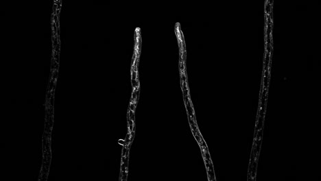 Hebras-De-Micelio-Que-Crecen-Bajo-Un-Microscopio:-Aspergillus-Fumigatus-Fotografiado-Usando-Microscopía-De-Fluorescencia-De-Barrido-Láser-Confocal