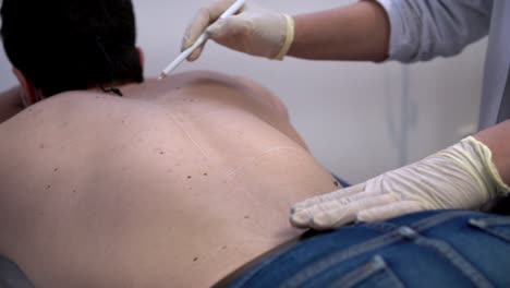 Pflanzenkosmetikerin-Markiert-Den-Rücken-Eines-Mannes-Für-Die-Laser-Haarentfernung