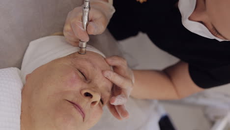 Kosmetikerin-Macht-Seniorin-Staubsaugen-Gesichtsmikrodermabrasion-Diamant-Peeling-Verfahren