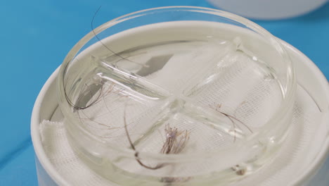 Surgical-vessel-with-long-hair-units-in-preservation-liquid-for-hair-transplant