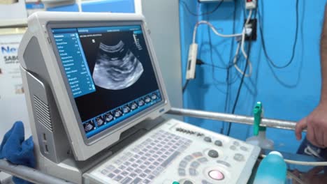 Close-up-shot-of-a-vet-diagnosing-problems-using-an-ultrasound-machine-and-pointing