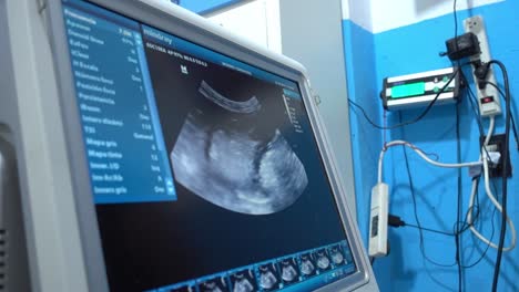 Push-in-shot-showing-the-images-being-transmitted-to-an-ultrasound-machine-from-an-animal