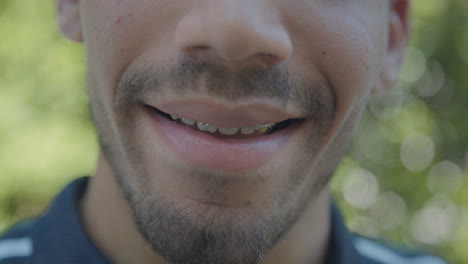 Closeup-of-smiling-young-Caucasian-mans-mouth-with-brackets