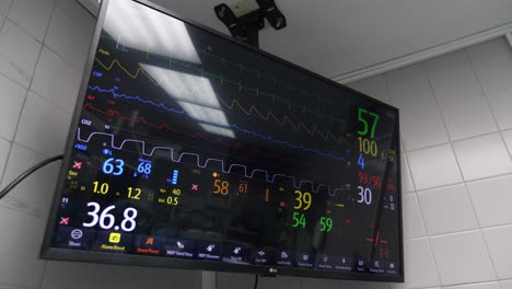Monitor-Im-Operationssaal,-Der-Herzfrequenz-Und-Blutdruck-Anzeigt
