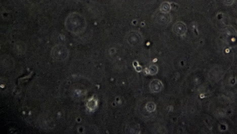 Espermatozoides-Individuales-Vistos-A-Través-De-Un-Microscopio-De-Contraste-De-Fases.