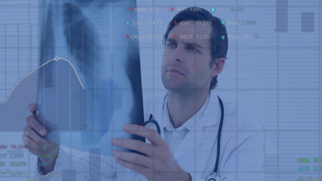 Animation-Der-Datenverarbeitung-über-Einem-Kaukasischen-Männlichen-Arzt,-Der-Ein-Röntgenbild-Hält