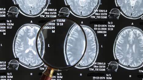 MRT-Gehirnscan-Hintergrund,-Magnetresonanztomographie.-Der-Arzt-Untersucht-Die-Bilder-Des-Patienten-Unter-Einer-Lupe.