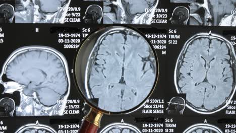 MRT-Gehirnscan-Hintergrund,-Magnetresonanztomographie.-Der-Arzt-Untersucht-Die-Bilder-Des-Patienten-Unter-Einer-Lupe.