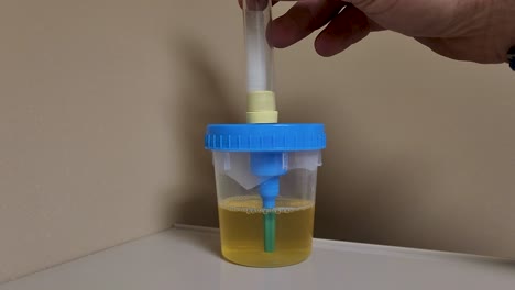 Urine-sample-filling-vacuum-test-tube-for-urinalyses
