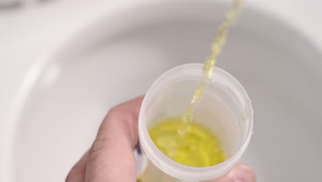 Providing-a-urine-sample-for-doctor-visit-or-urinalysis-drug-test