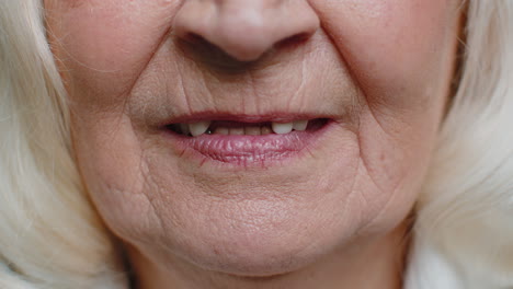 Nahaufnahme-Eines-Zahnlosen-Lächelns-Im-Mund-Einer-älteren-Frau.-Zahnprobleme,-Schlechter-Zahnverlust