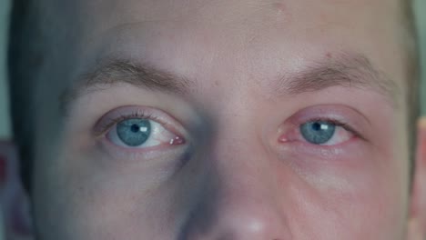 Die-Roten-Augen-Eines-Deprimierten-Mannes-Nach-Dem-Weinen,-Nahaufnahme