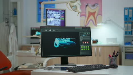 Sala-Médica-De-Odontología-Vacía-Con-Rayos-X-Digitales-En-La-Computadora