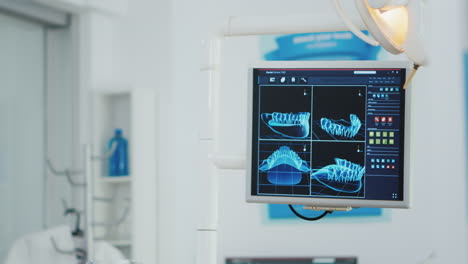 Close-up-of-teeth-radiography-on-monitor-in-modern-stomatology-orthodontic-hospital-bright-office.
