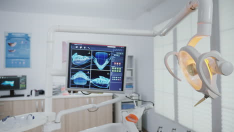 Nahaufnahme-Von-Röntgenbildern-Stomatologischer-Zähne-Auf-Dem-Monitor,-Die-Die-Zahnpflegebehandlung-Offenbaren.