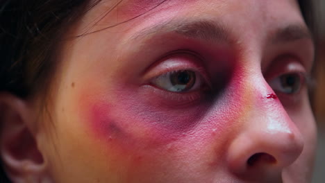 Close-up-of-face-with-bruise