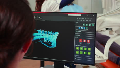 Stomatologist-nurse-looking-at-digital-dental-fingerprint-on-computer