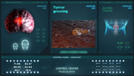Tumor-Wachsender-Medizinischer-Hud