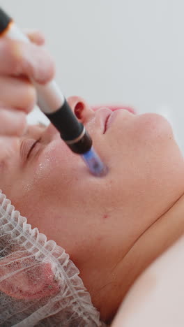 Cosmetologist-doing-peeling-procedure,-woman-skin-regeneration,-dermapen-microneedling,-dermastamp