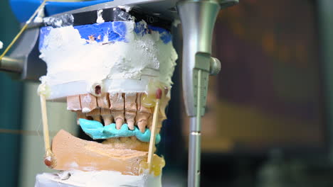 Static-shot-of-a-dental-mould-being-imprinted-within-a-dental-laboratory