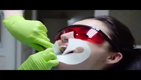 Closeup-view-of-the-dentist's-hands-putting-rubber-dam-in-a-mouth-of-a-female-patient.-Shot-in-4k