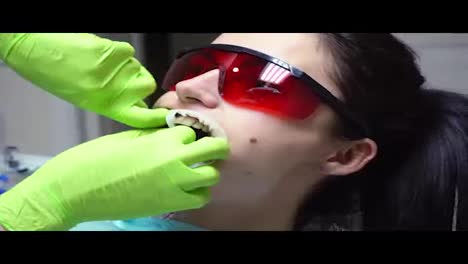 Nahaufnahme-Der-Hände-Des-Zahnarztes,-Die-Einen-Kofferdam-In-Den-Mund-Einer-Patientin-Stecken.-In-4k-Gedreht