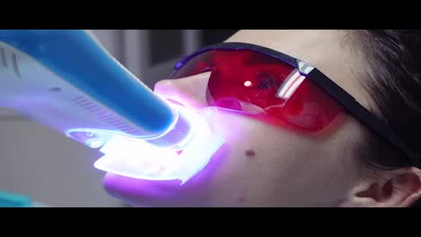 Junge-Frau-Mit-Einem-Expander-Im-Mund-Und-Roter-Schutzbrille-Lässt-Sich-In-Der-Zahnarztpraxis-Mit-Einem-UV-Gerät-UV-aufhellen.-In-4k-Gedreht