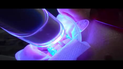 Blanqueamiento-Dental-Ultravioleta:-Primer-Plano-De-Una-Máquina-Blanqueadora-Ultravioleta-En-Funcionamiento-En-Los-Dientes-De-Un-Paciente.-Filmado-En-4k