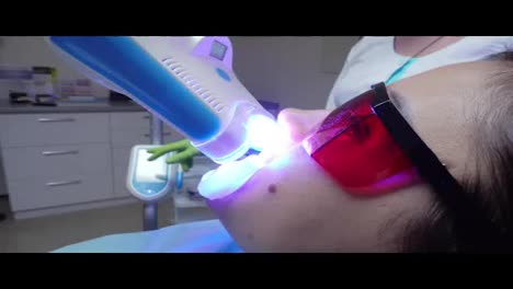 Young-woman-with-an-expander-in-mouth-and-red-protective-glasses-getting-UV-whitening-at-the-dentist's-office-by-an-ultra-violet-machine.-Shot-in-4k.