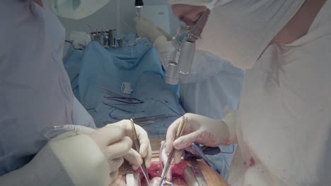 Medical-staff-during-a-heart-operation-3-Close-up