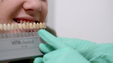 Der-Zahnarzt-Passt-Mithilfe-Der-Farbskala-Die-Richtige-Zahnrestaurationsfarbe-An