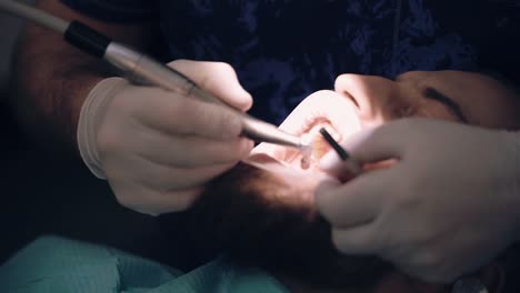 Zahnarzt-Verfeinert-Die-Zahnrestauration-Im-Mund-Des-Patienten-Durch-Polieren-Von-Scheiben