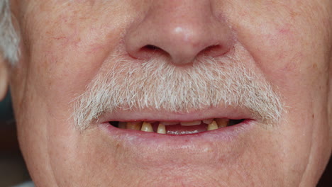 Toothless-male-smile-mouth-of-senior-elderly-old-man,-dental-problem,-bad-rotten-teeth-loss,-caries