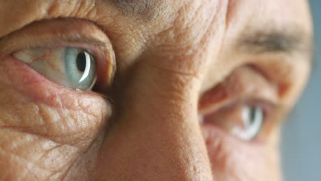 Eyes-of-elderly-senior-woman-with-poor-mental