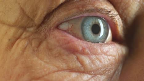 Vision,-eye-and-healthcare-with-a-senior