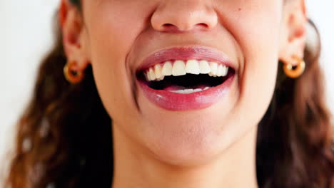 Closeup-of-laughing-woman-showing-crooked-teeth