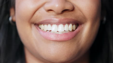 Closeup-of-smiling-ptient-showing-perfect-white