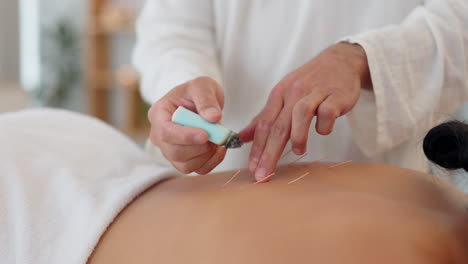 Acupuncture,-health-spa-and-wellness-therapy