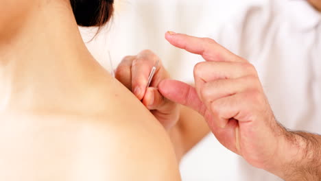 Shoulder,-acupuncture-and-hands-of-therapist
