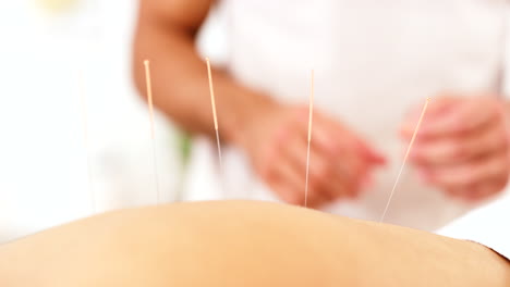 Relax,-acupuncture-therapy