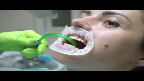 Dentist-using-saliva-ejector-or-dental-pump-to-evacuate-saliva.-Young-woman-with-and-expander-in-mouth-at-the-dental-clinic