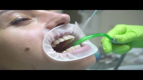 Young-woman-with-and-expander-in-mouth-at-the-dental-clinic.-Cleaning-teeth-with-water.-Modern-dental-office.-Dentist-using