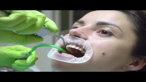 Young-woman-with-and-expander-in-mouth-at-the-dental-clinic.-Cleaning-teeth-with-water.-Modern-dental-office.-Dentist-using
