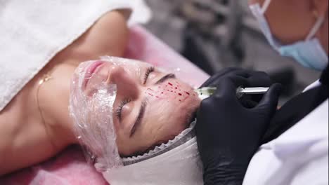 Close-Up-view-of-a-professional-cosmetologist-in-black-gloves-making-multiple-injections-in-woman's-face-skin-during-mesotherapy