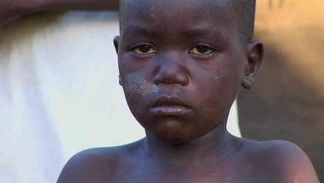 Closeup-shot-of-a-beautiful-young-African-child-in-Africa-3
